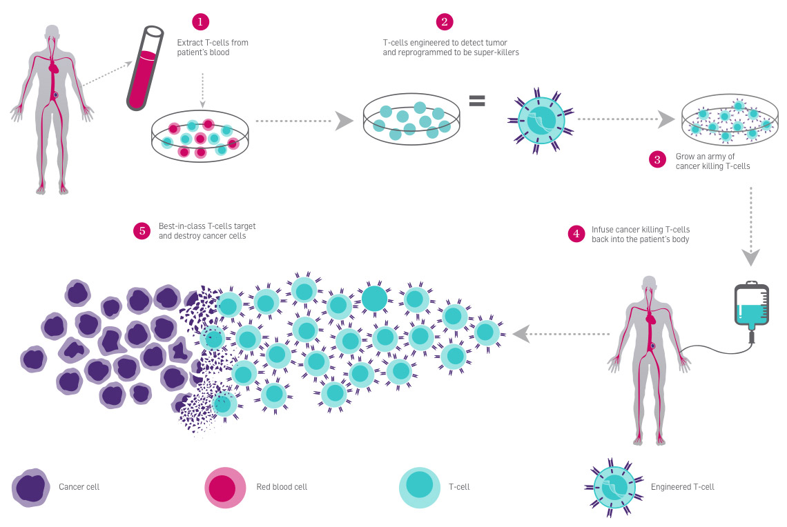 Engineering TCells to Fight Cancer Parker Institute for