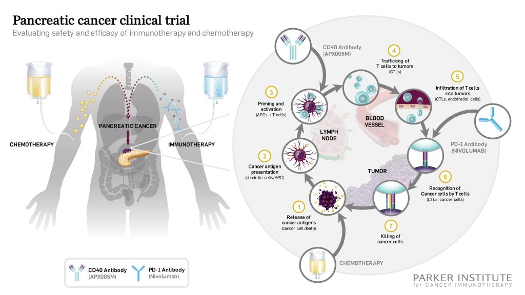 Pancreatic Cancer Clinical Trial with Immunotherapy and Chemotherapy